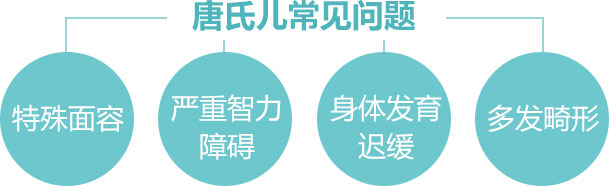 唐氏患儿都有哪些特征？特殊面容严重智力障碍身体发育迟缓多发畸形